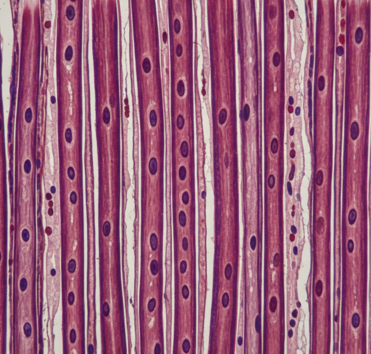 Ciliary muscle